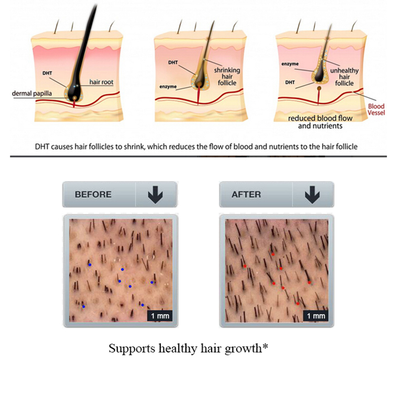 PURC Ginger Hair Loss Shampoo  - огляд і ціна Licorice Root Sticks